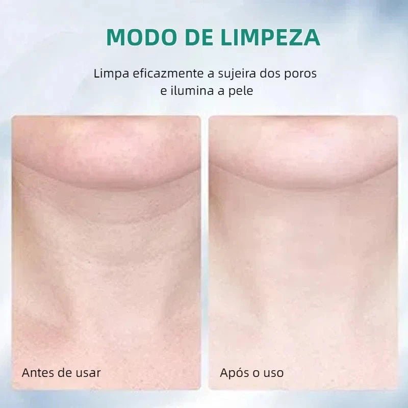 Massageador Facial com Fototerapia Anti-Rugas